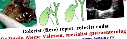 vasbetegségekben diéta