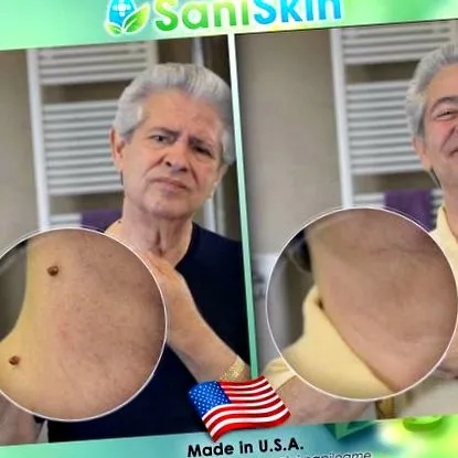 saniskin saniskin