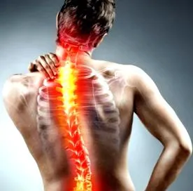 mellkasi osteoarthritis