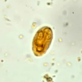 giardiasis