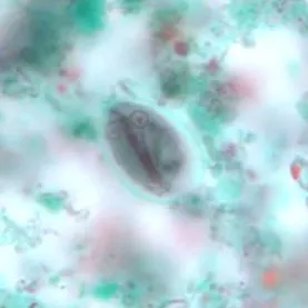 giardiasis