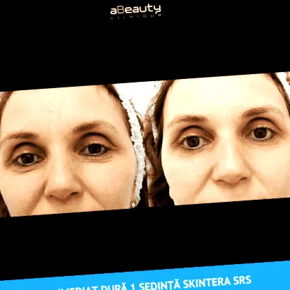 őssejtes