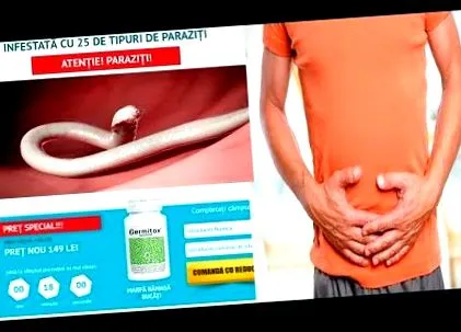 esetén fekélyes