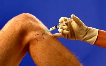 osteoarthritisének