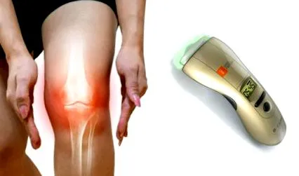 kezelése osteoarthritis