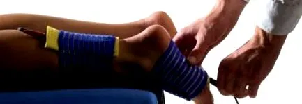 vállízület chondrosisának