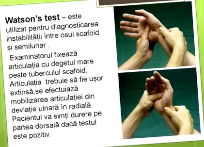 tudni kell