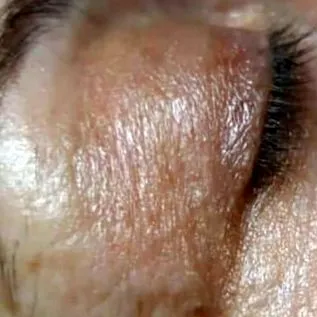 selenia kombinálja