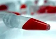 сечова