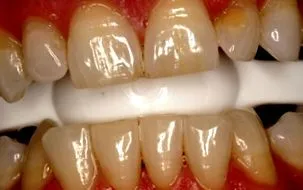 prodent