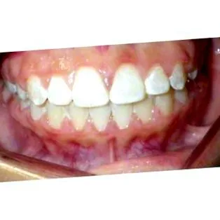 prodent