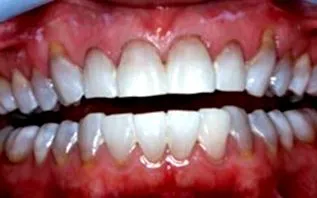 prodent