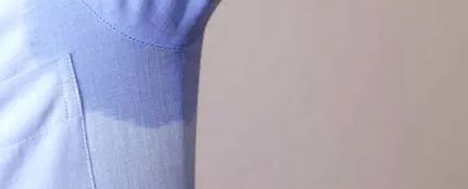izzadást