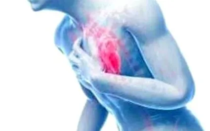 angina