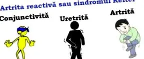 това артроза
