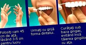 udržanie