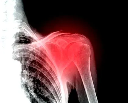 méhek
