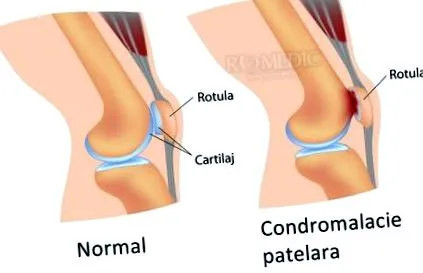 gonarthrosis doctor
