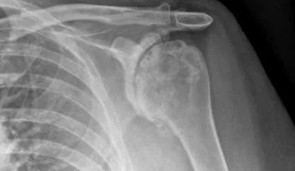 оваа состојба