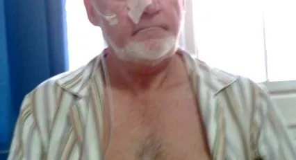 alebo žalúdka