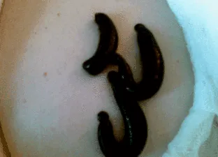 endokrinné
