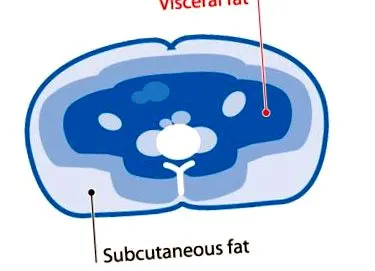 elektronikus mérleg
