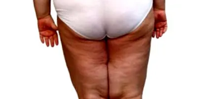 svete