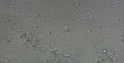 giardiasis konyaev