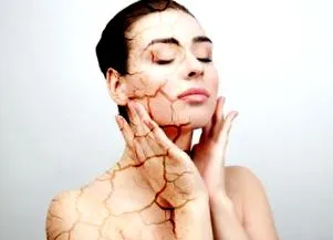 karikák