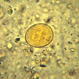 giardia kezelése