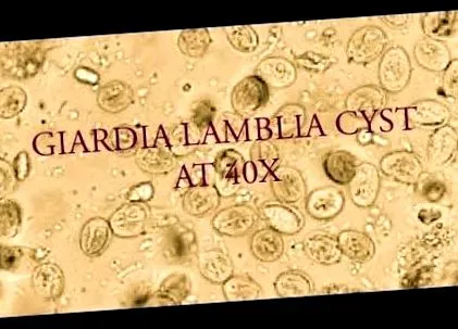 minden lamblia