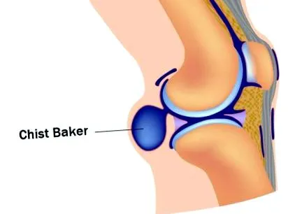 baker