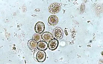 lumbricoides