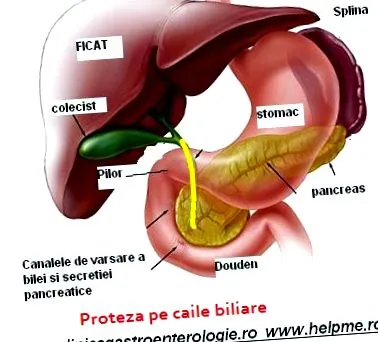 epevezeték