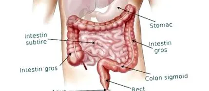 colostomia colostomia