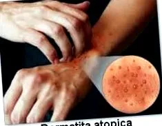 лекари