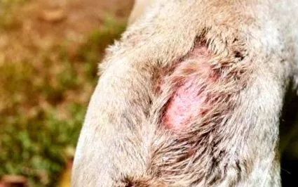 dermatitis