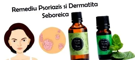 dermatitis