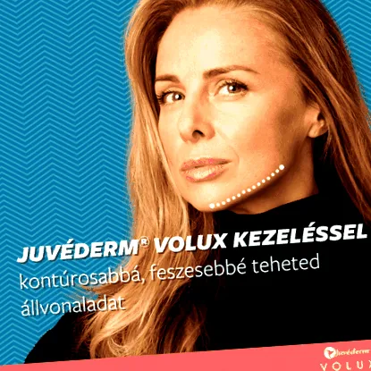 контуриране киселина Juvéderm®