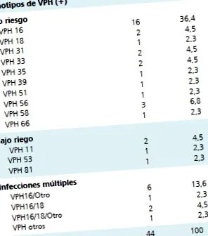 ревизија