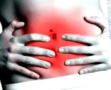 fodmap