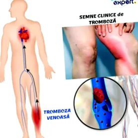 vénák