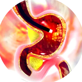 emésztőrendszeri