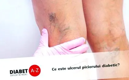 diabetes-az