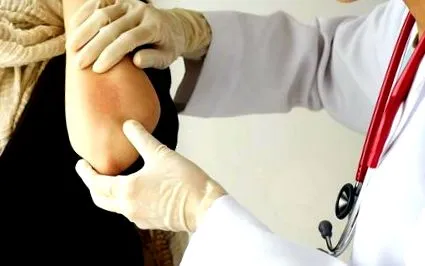 gyermekkori dermatitis