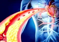 cardiology