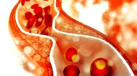 cardiology