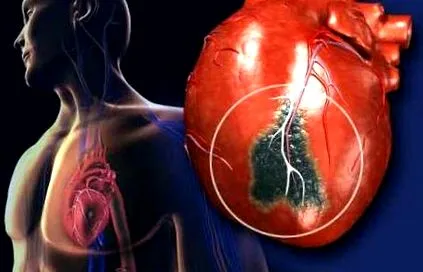 cardiology