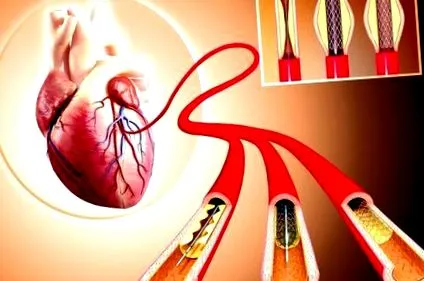 cardiology
