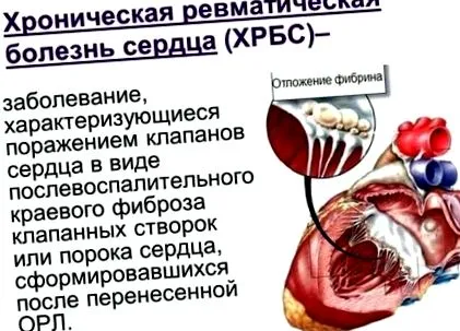 біль